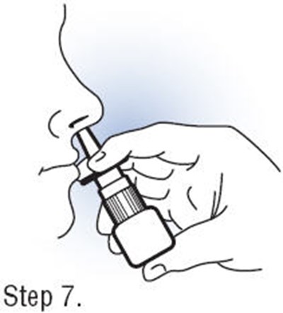 Step 7 (Fortical 08)