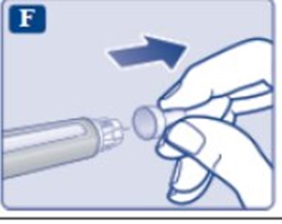 Step 1 (Fig. F)