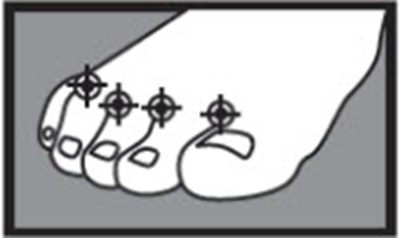 Figure - terbinafine 01