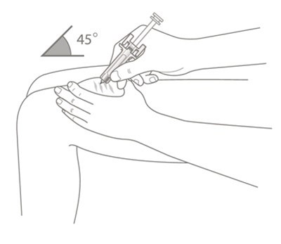 figure-i-vial - figure i vial