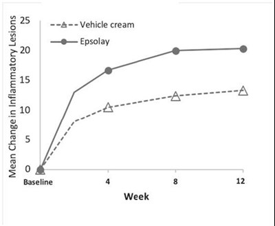 Figure 4 - epsolay 05