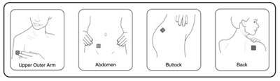 Choosing A Place On The Body To Put The Tds (Image 01)
