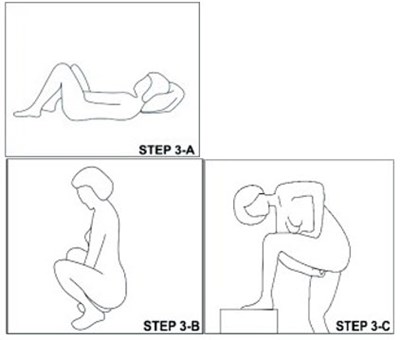 Figure (Annovera 10)