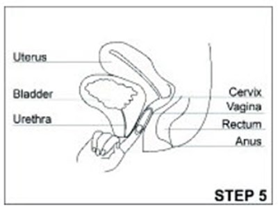 Figure (Annovera 13)