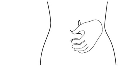 Figure J (Firazyr 12)