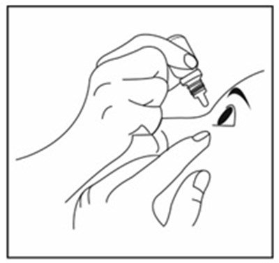 Dorzolamide Hydrochloride Ophthalmic Solution Figure E (Dorzolamide HCl Opthl Sol Fig E)