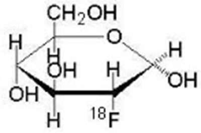 Chemical Structure - fludeoxyglucose 01