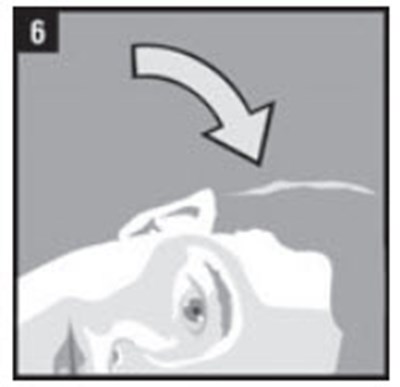 Step 6 (Clotic 07)
