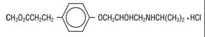 Esmolol Hydrochloride Structural Formula (Image 01)