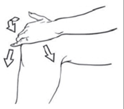 Figure B - diclofenac 04