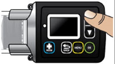 Figure Cs (Onapgo 104)