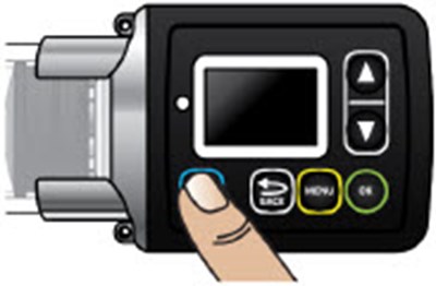 Figure Ct (Onapgo 106)