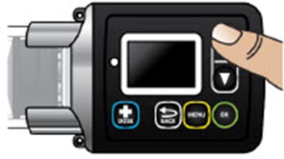 Figure Du (Onapgo 120b)