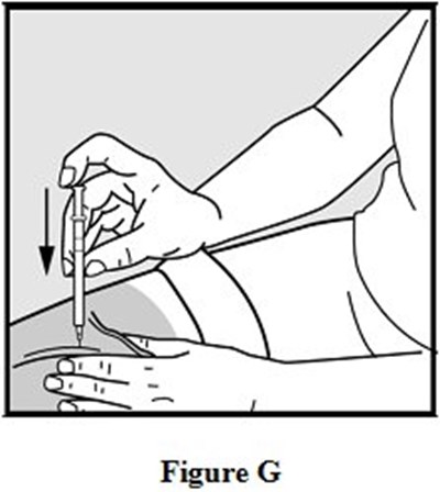 Instructions For Use Figure G (Image 08)