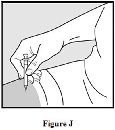 Instructions For Use Figure J (Image 11)