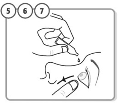 Ifu Step 5-6-7 (Zolymbus 04)