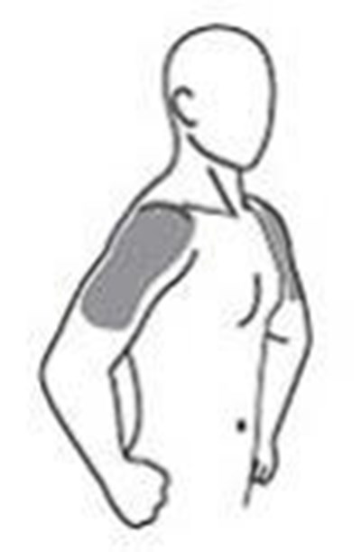 Andro Shoulders Side View (Androgel 1 62 Spl 02)