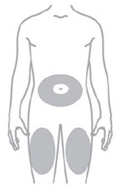 Figure (Moun Vial Ifu 16 V1)