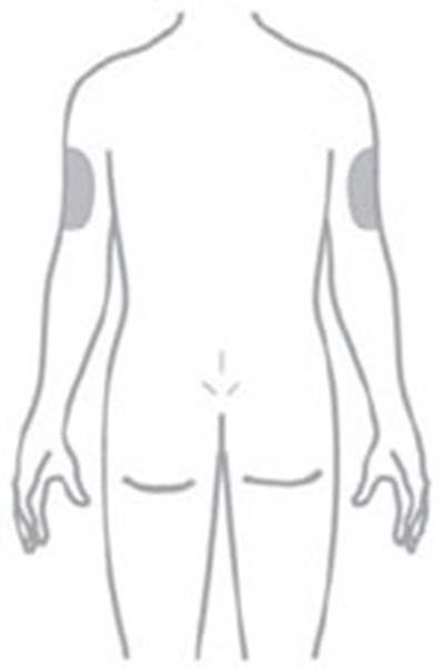 Figure (Moun Vial Ifu 17 V1)