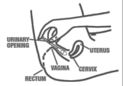 Perrigo Logo.jpg - image 05