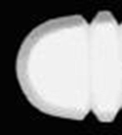7.5 mg Tablet (Buspirone HCl Tabs 4)
