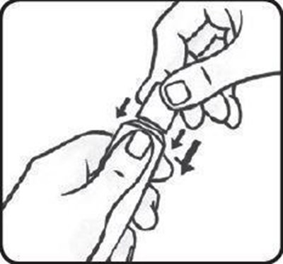 Twist-off-cap-fig-a (Twist Off Cap Fig A)