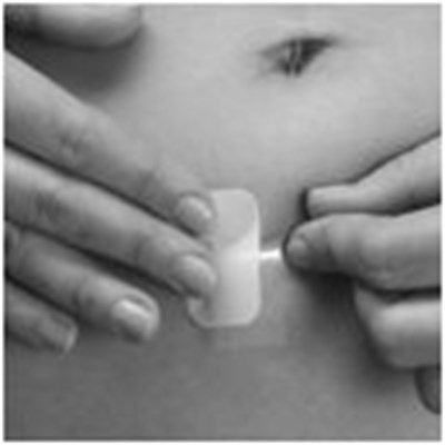 How To Apply The Patch Figure 03 (Image 05)