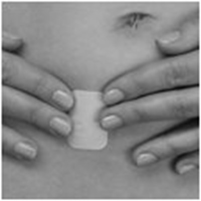 How To Apply The Patch Figure 04 (Image 06)