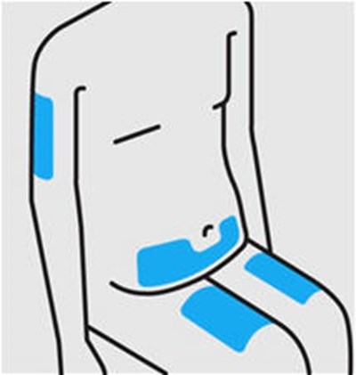 simponi-10.jpg Figure - simponi 10