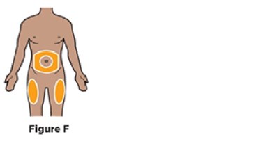 Figure 7 (Avt02 Unbranded Birdi 11)