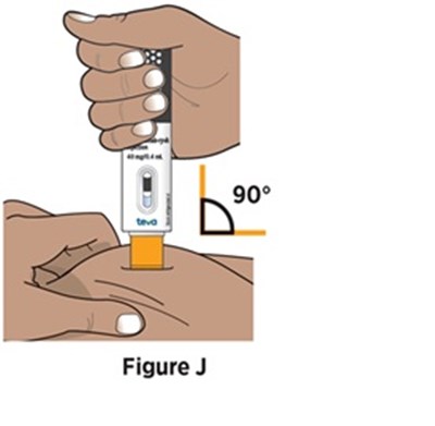 Figure 11 (Avt02 Unbranded Birdi 15)