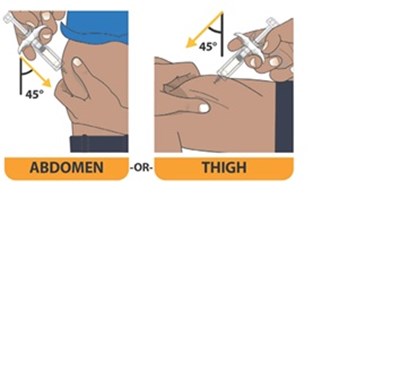 Pfs Figure 40 (Avt02 Unbranded Birdi 44)