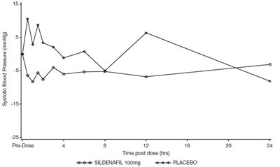 10 (Sildenafil Tablets 25 50 100 2)