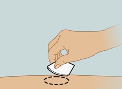 Step 5 (Adalimumabqt 10)