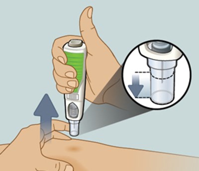 Step 10 (Adalimumabqt 15)
