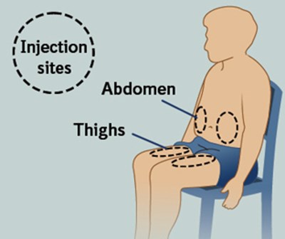 Step 4 (Adalimumabqt 22)