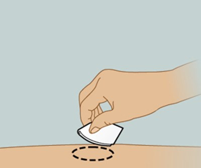 Step 5 (Adalimumabqt 23)