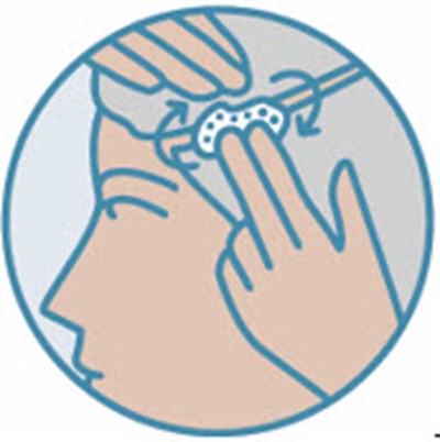 Image (Zoryve 06)