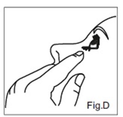 Fig D (Dorzolamidefigd)