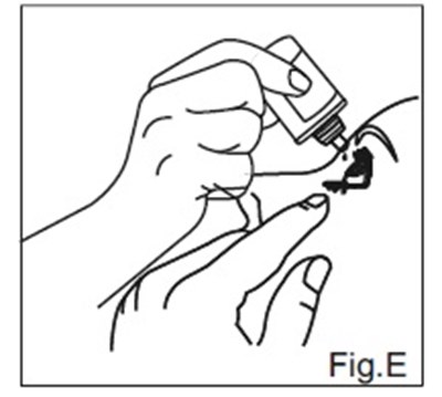 Fig E (Dorzolamidefige)