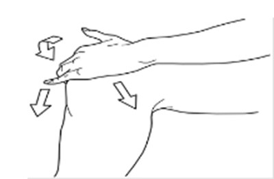 Figure D (Diclofenac Sodium Topical Solution 5)