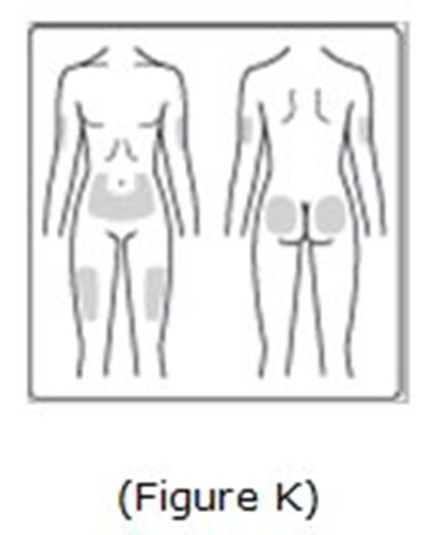 Image of possible injection sites. - image 09