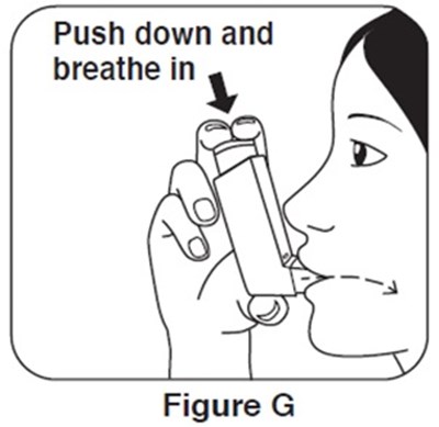 Image Description (Albuterol Sulfate Picture 7)
