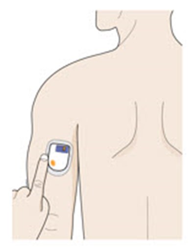 Figure - neulasta 13