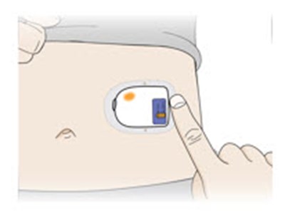 Figure - neulasta 14