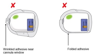 Figure - neulasta 18