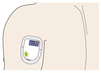 Figure - neulasta 59