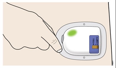 Figure - neulasta 65