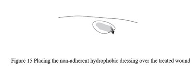 Fig15 (Fig15)
