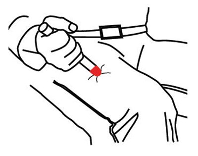 Directions For Use (Epinephrine Injection Usp Auto Injector 5)